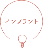 インプラント